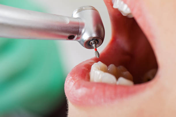 Best Emergency Cosmetic Dentistry in Milan, MO